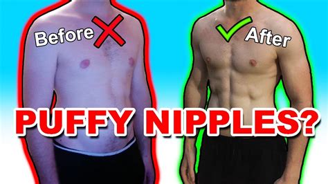 how to get rid of puffy nipples in women|Nip and Tuck: How to Fix Protruding Nipples – Exploring Surgical ...